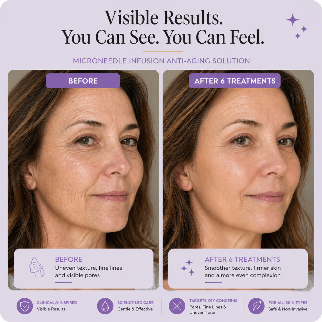 Dermique Skin-Regenerating Micro-Infusion®