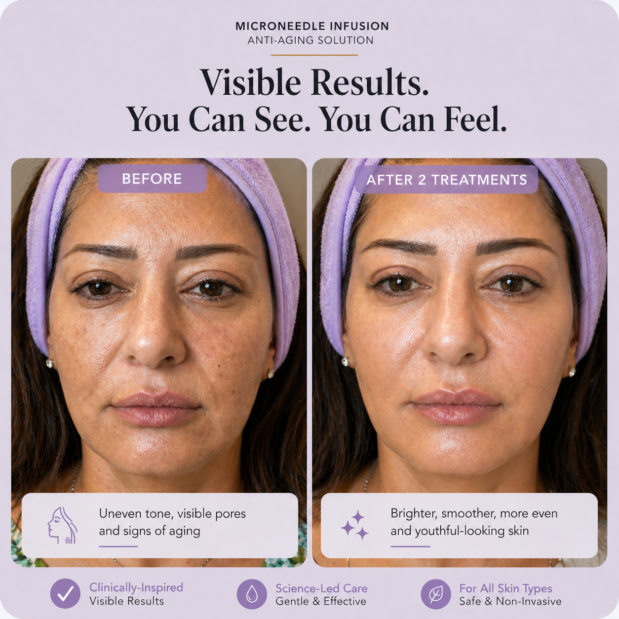 Dermique Skin-Regenerating Micro-Infusion®