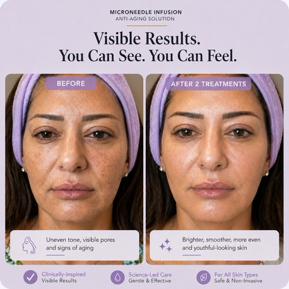 Dermique Skin-Regenerating Micro-Infusion®