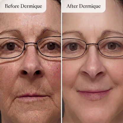 Dermique Micro-Infusion System®